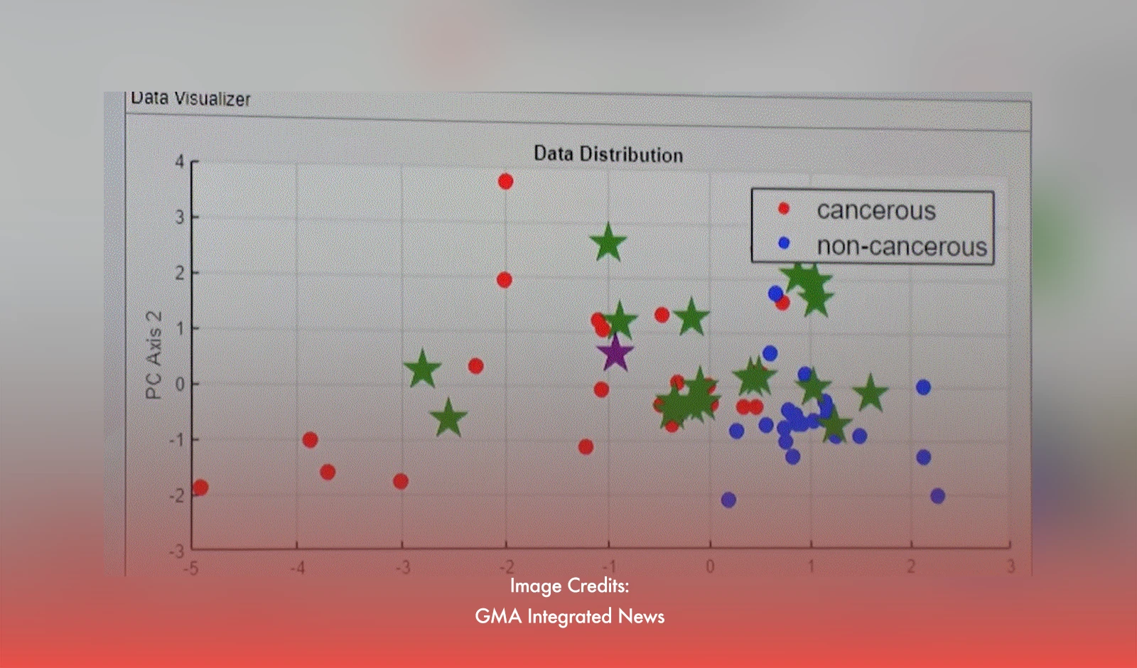 UST Students Use AI To Help Detect Colorectal Cancer