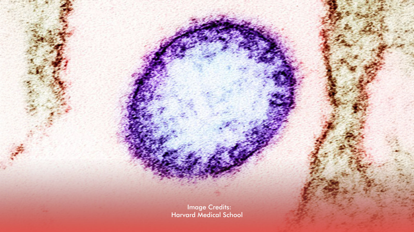 Nipah Virus: What Filipinos Need To Know As DOH Steps Up Monitoring