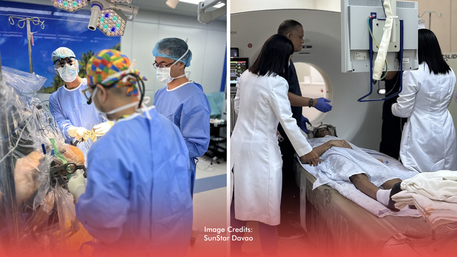 SPMC Makes History With First Adaptive Deep Brain Stimulation In PH